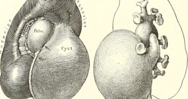 Tegninger af blære og nyrer