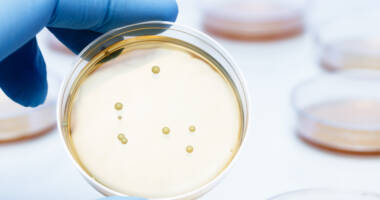 Petriskål med bakteriekoloni